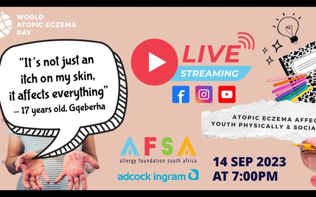 Live Event: If Only You Knew: Atopic Eczema Affects Youth Psychically & Socially